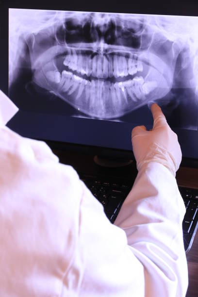 Best Emergency Root Canal Treatment in Capitol View, SC