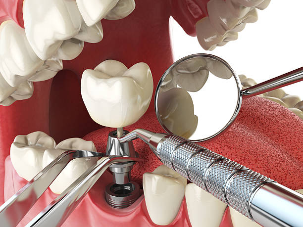 Best Emergency Dental Services for Seniors in Capitol View, SC