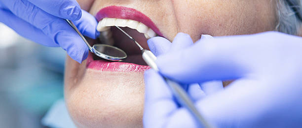 Best Emergency Dental Care for Abscessed Tooth in Capitol View, SC